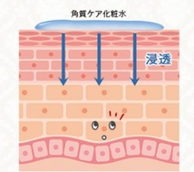 ドクターシムラ（Dr-Shimura）角質ケア化粧水の口コミ効果！他のピーリング剤と違い安全安心の噂は本当？